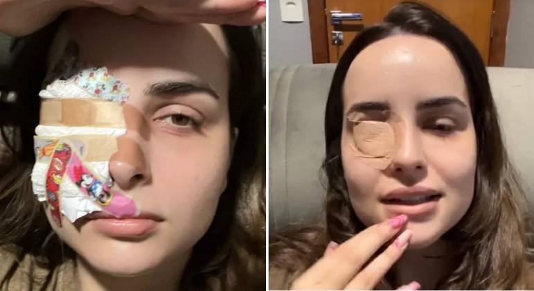 Influencer arranca lasca da córnea ao coçar os olhos com as unhas grandes