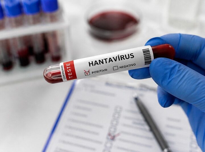 Hantavirose volta a ser investigada após 7 anos sem casos em Mato Grosso do Sul