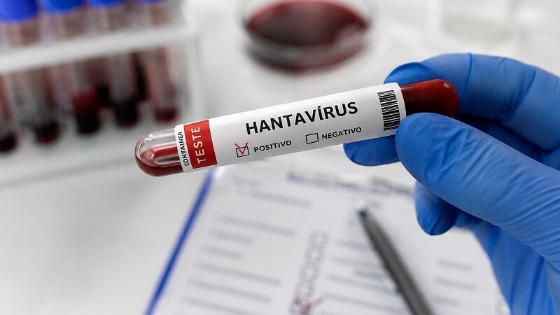 Hantavirose volta a ser investigada após 7 anos sem casos em Mato Grosso do Sul